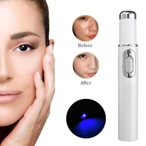 Laser Pembunuh Kuman dan Bakteri untuk muka Berjerawat, Perawatan Muka berjerawat, AMPUH membunuh kuman di jerawat Pen LED Biru Laser Penghilang Jerawat Acne Treatment Acne Laser Pen Portable Wrinkle Removal Machine Durable Blue Light Therapy Massage