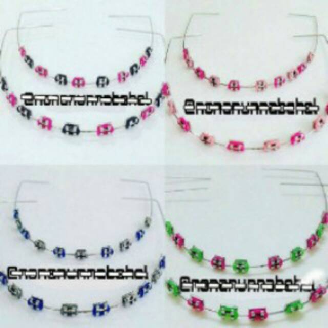 Behel lepas pasang