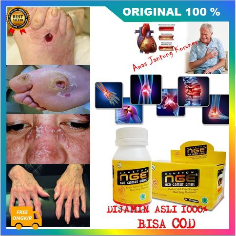 [BISA COD]  NGE Neo Gamat emas 77 kapsul ORIGINAL