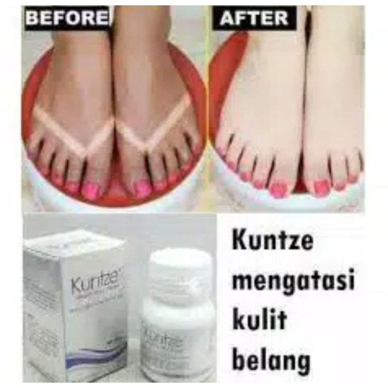 KUNTZE bleaching pemutih badan bpom