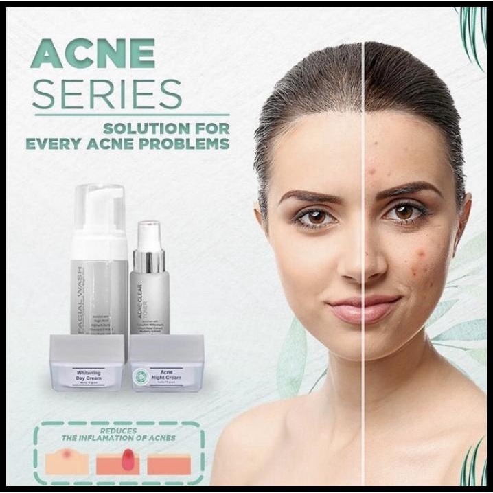 Caramel | Acne Series Msglow Paket Wajah Acne Series Ms Glow Paket Lengkap