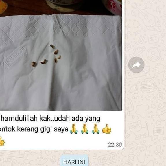 ♦ Whitening Teeth Ori pasta pemutih gigi ✥