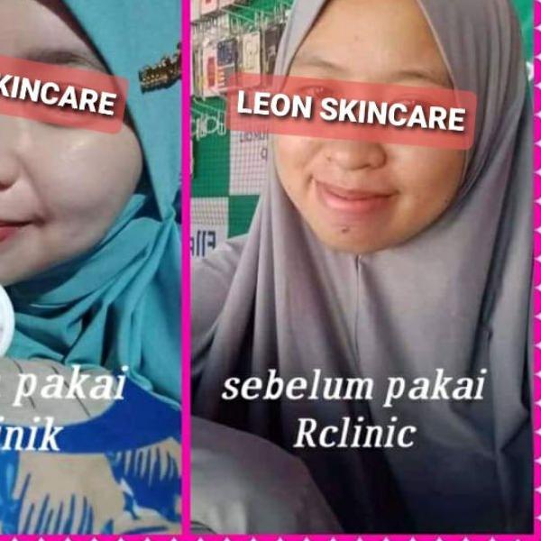 PELICIN WAJAH GLOWING (RCLINIC DOKTER)