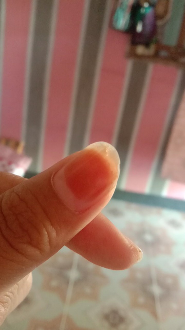 Rinso Anti Noda Gentle 700ml