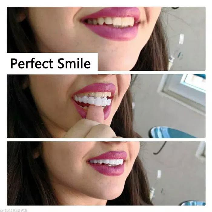 Promo Harga Murah Snap On Smile Gigi Palsu Snap Instan Perfect Smile Indonesia