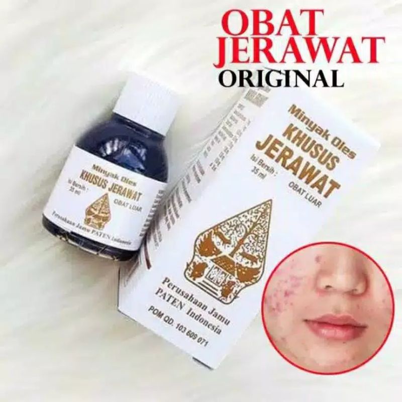 OBAT JERAWAT WAYANG ORIGINAL - MINYAK OLES CAP WAYANG - MINYAK JERAWAT WAYANG