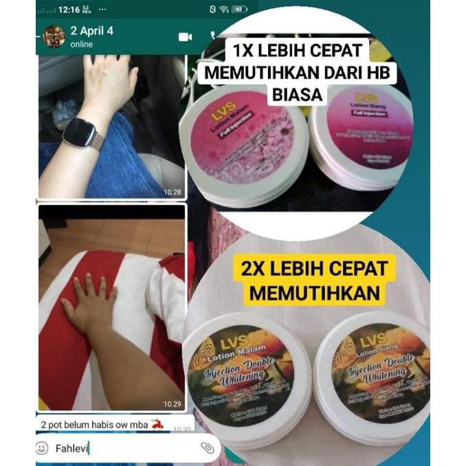 HB INJECTION - HB DOUBLE WHITENING