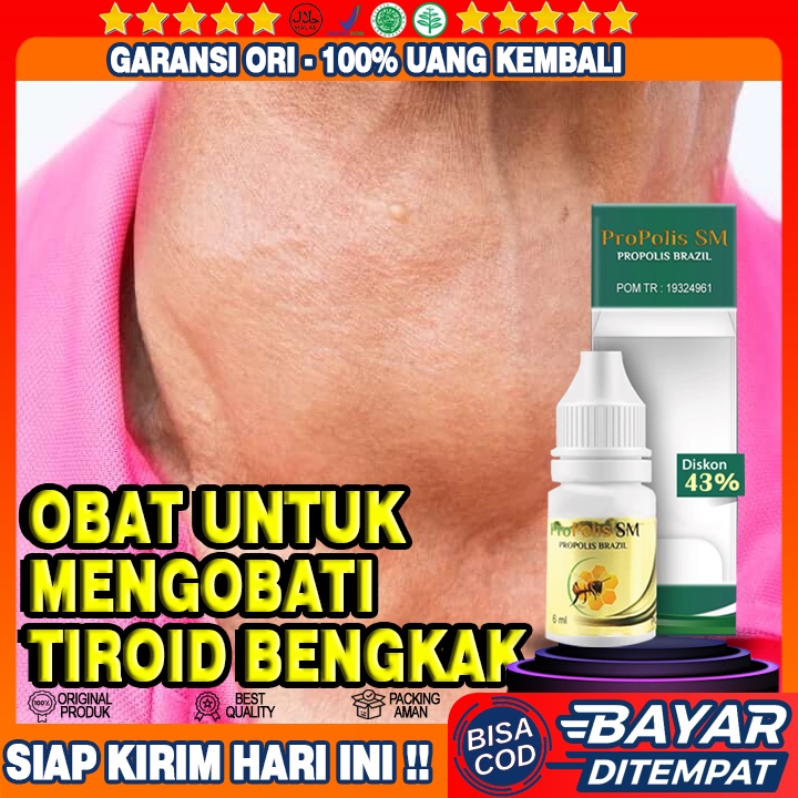 Obat Tiroid Bengkak - Kelenjar Tiroid Bengkak - Kelenjar Tiroid - Hipertiroid - Benjolan di Leher