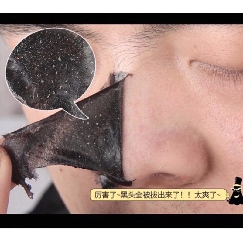 4 PCS BLACKHEAD EX PORE STRIP LIFE MING YUAN / ANTI BLACKHEAD NOSE MASK / MASK CHARCOAL AKTIVED