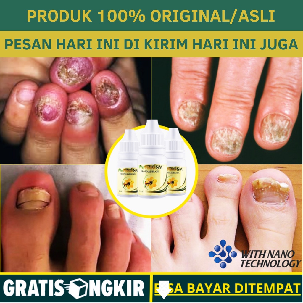 Perawatan Kuku Untuk Lelaki – Bukan Hanya Untuk Wanita!