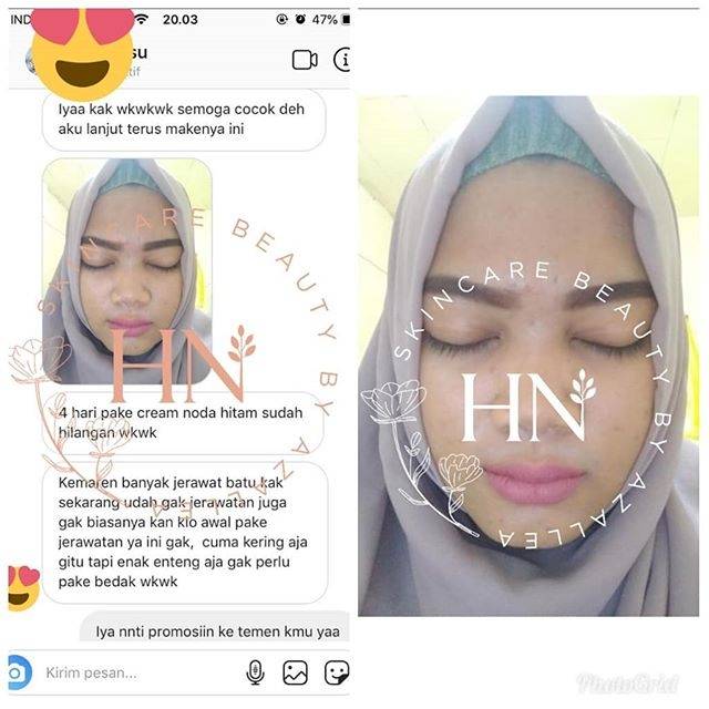 Testimoni Cream HN by Azallea skincare beauty