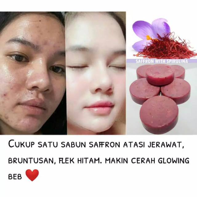 Sabun safron aleya bpom with spirulina kk sabun jerawat