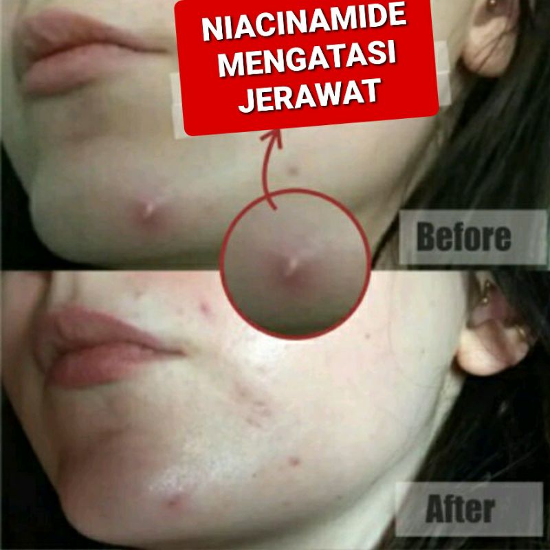 (10gr ) NIACINAMIDE IMPORT VITAMIN B3 COSMETIC GRADE