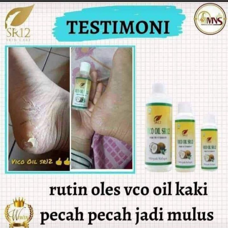 Obat Kaki Pecah dan Kering - Penghalus Tumit Kaki - Minyak Kaki Pecah2 Ampuh