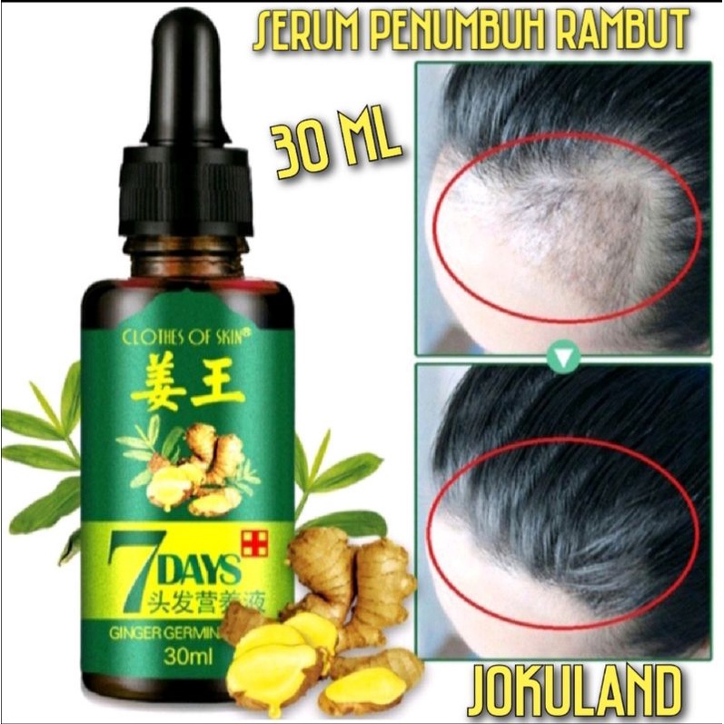 HAIR TONIC 7DAYS 7 DAYS PENUMBUH RAMBUT BOTAK RONTOK 7 Days Ginger Germinal Oil - Serum Korea Penumb