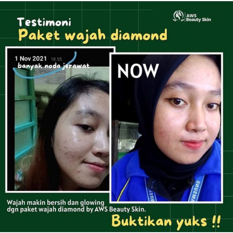Paket perawatan wajah berkwalitas super.-3