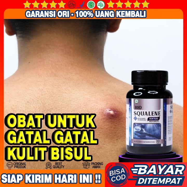 Obat Gatal Kulit Bisul - Obat Bisul Di Bokong - Obat Benjolan Bernanah - Obat Bisul Darah Kotor - Ke