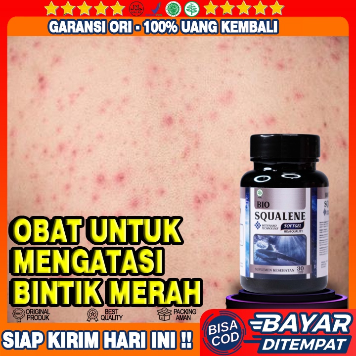 Obat Untuk Mengatasi Bintik Merah Pada Kulit - Obat Gatal - Gatal Seluruh Badan - Obat Herbal Anti A