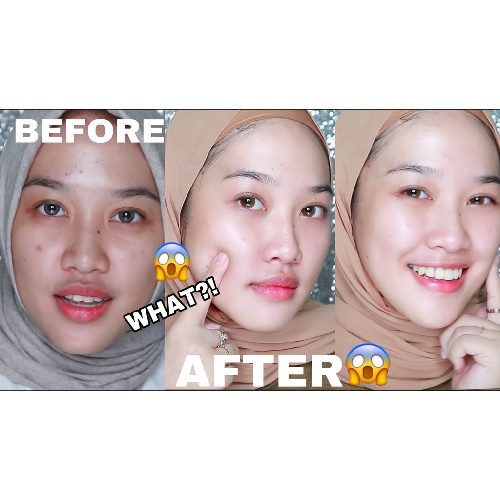 Beacuir Serum Penghilang Jerawat Cepat