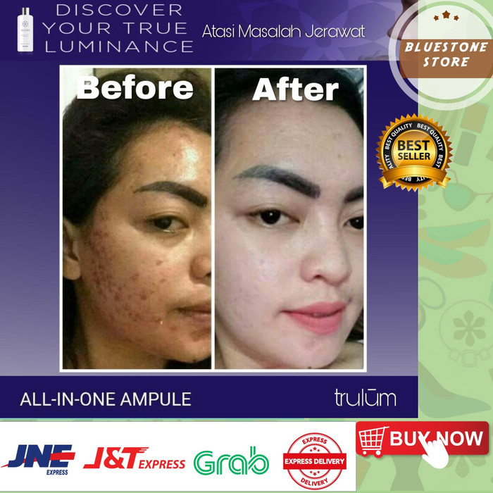 ♨TW✫ Cream Pemutih Wajah Penghilang Flek Hitam Di Wajah krim Bopeng bekas jerawat wajah ampuh