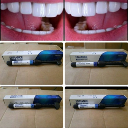 1 pcs Composite Sincera Xw, A1, A2, A3, Tambal Gigi Kelinci dan Veneer Gigi 4gram
