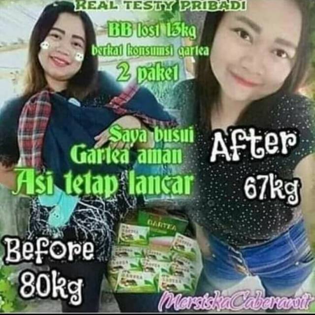 Gartea MSI pelangsing herbal