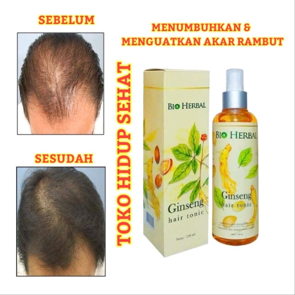 [COD] Tonic Mengobati Rambut Rontok Menumbuhkan dalam 2 Minggu  Dengan Gingseng Asli  | Bio Herbal B