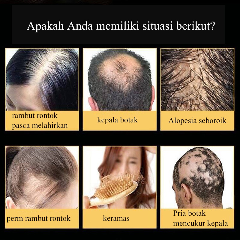 hair tonik 30ml penumbuh rambut/penumbuh rambut botak/serum penumbuh rambut/Memperbaiki folikel rambut/merangsang pertumbuhan rambut/perawatan rambut