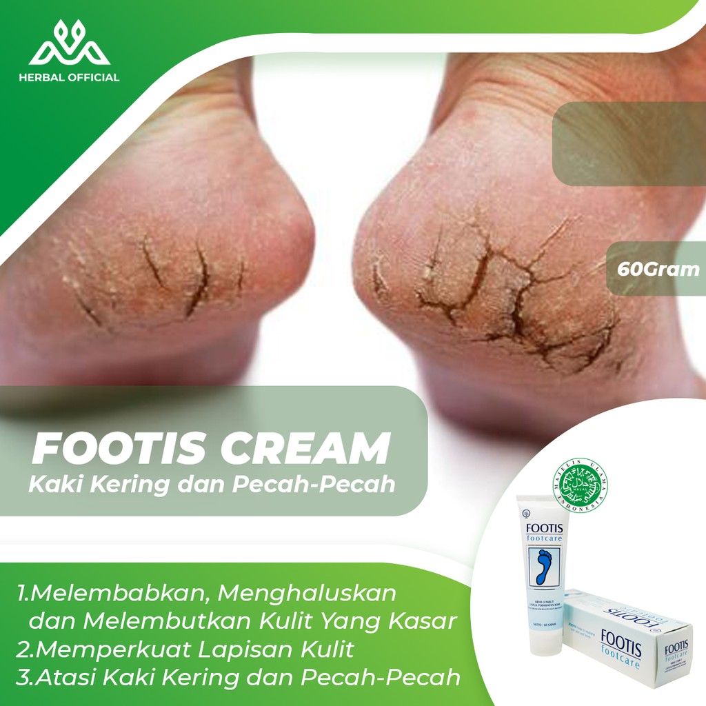 Footis Footcare Cream 60 | Cream Kaki Pecah Kering Ampuh | Obat Kaki Pecah Dan Kering | Kaki Pecah2