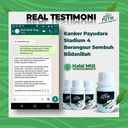 

Obat Herbal Kunyit Putih Kunir Putih Obat Berbagai Macam Penyakit Garansi 100% Uang Kembali