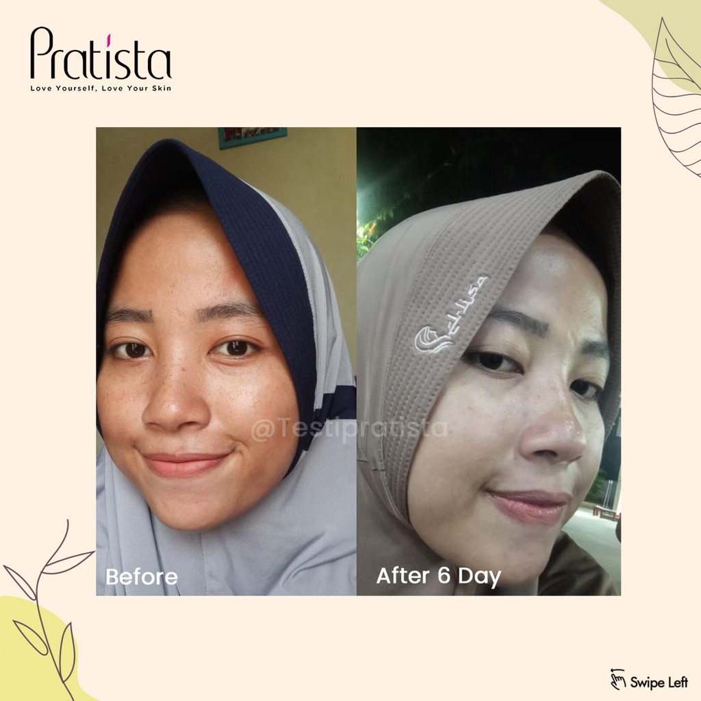 PRATISTA CALMING SPRAY CICA HYDRATING MIST FACE SPRAY HYALU TONER FACE SPRAY FACE MIST CALMING CICA SPRAY PRATISTA TONER 100ML | RETINOL RENEWAL SERUM 10ML 30ML BY PRATISTA SKINCARE SERUM RETINOL CALMING SPRAY PRATISTA.ID SERUM JERAWAT RETINOL VIRAL