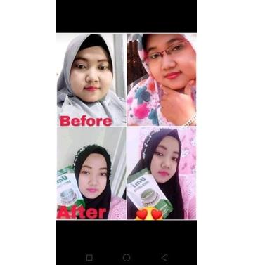 Turun BGT UMI GREEN COFFEE ORIGINAL 100% dengan cara scan barcode hasilnya UGC, dari distributor Res