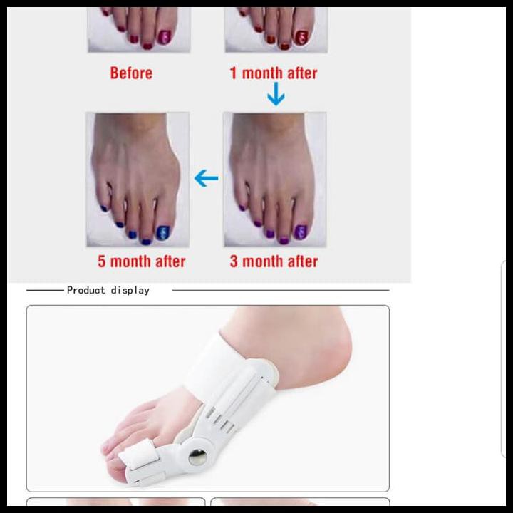 BUNION THERAPHY DR HALLUX VALGUS