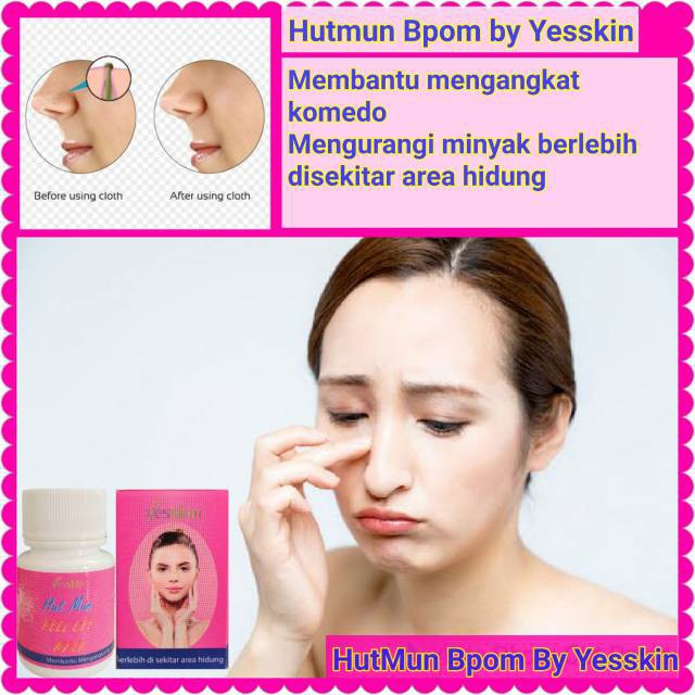 (INEED) Yesskin HUT MUN GEL - HutMun Gel by Yesskin