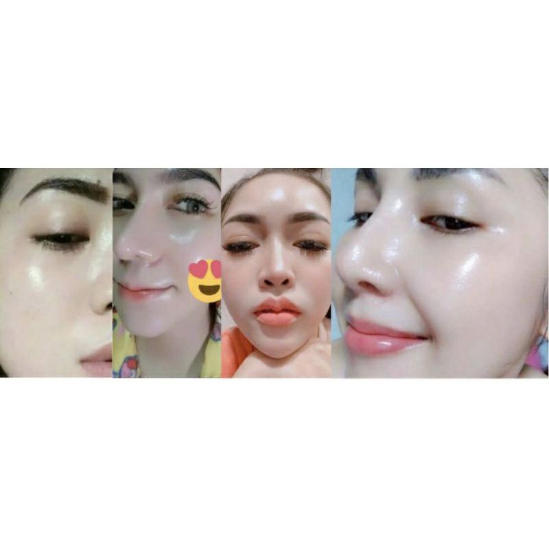 SALEP FLEK AMPUH || SALEP FLEK NIGHT || SALEP FLEK HITAM || SALEP MELASMA || CREAM FLEK || SALEP FLEK MEMBANDEL