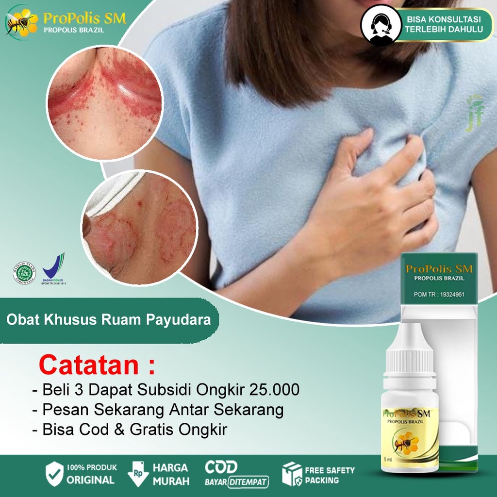 Jual Obat Ruam Pada Payudara Bintik Merah Berair Bernanah Scabies Eksim