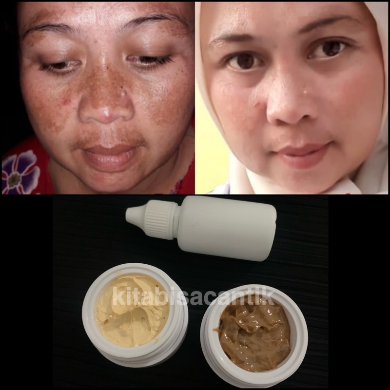 PAKET KEONG / FLEK CREAM VIT GLOW / vitamin glowing / cr glow