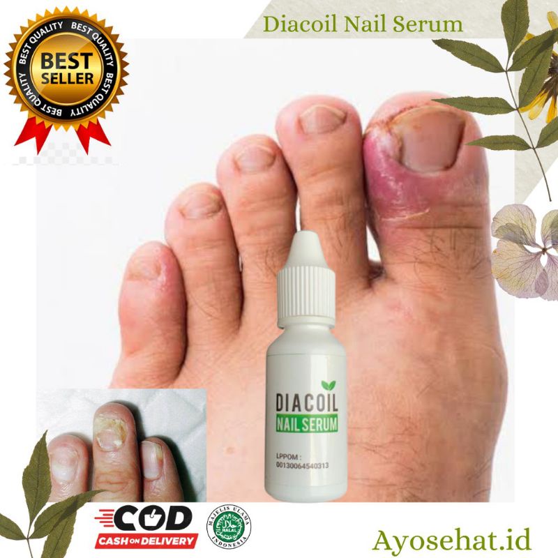SERUM JAMUR KUKU | DIACOIL OBAT JAMUR KUKU | ORIGINAL