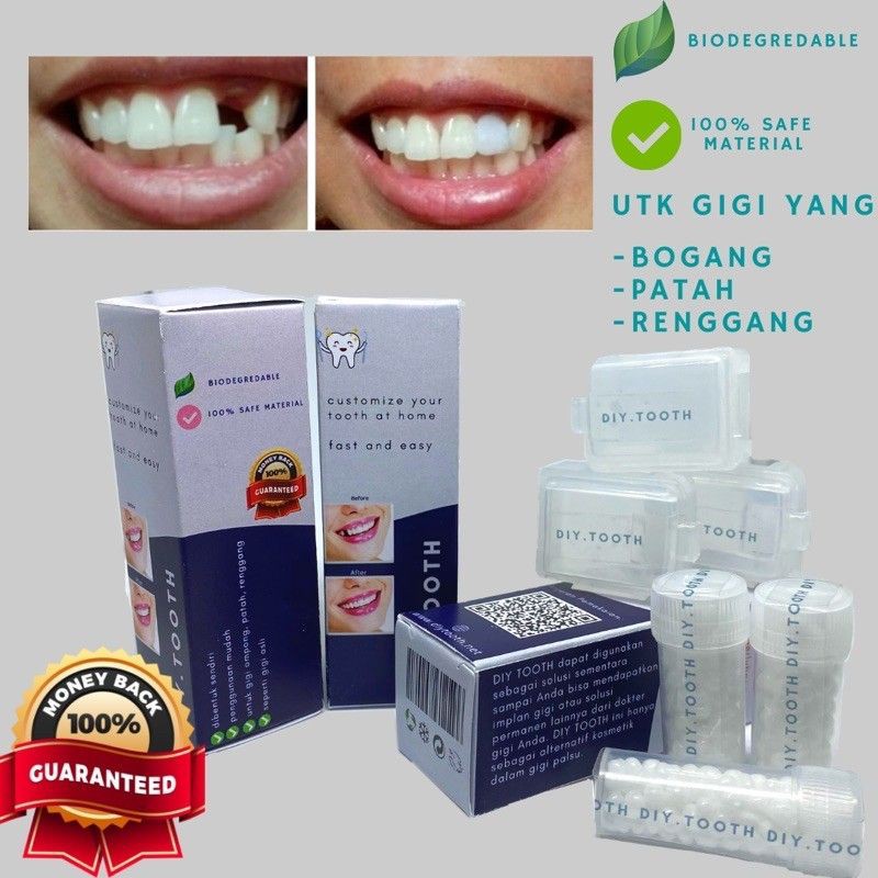 Gigi Palsu /DIY TOOTH / GIGI PALSU SEMENTARA