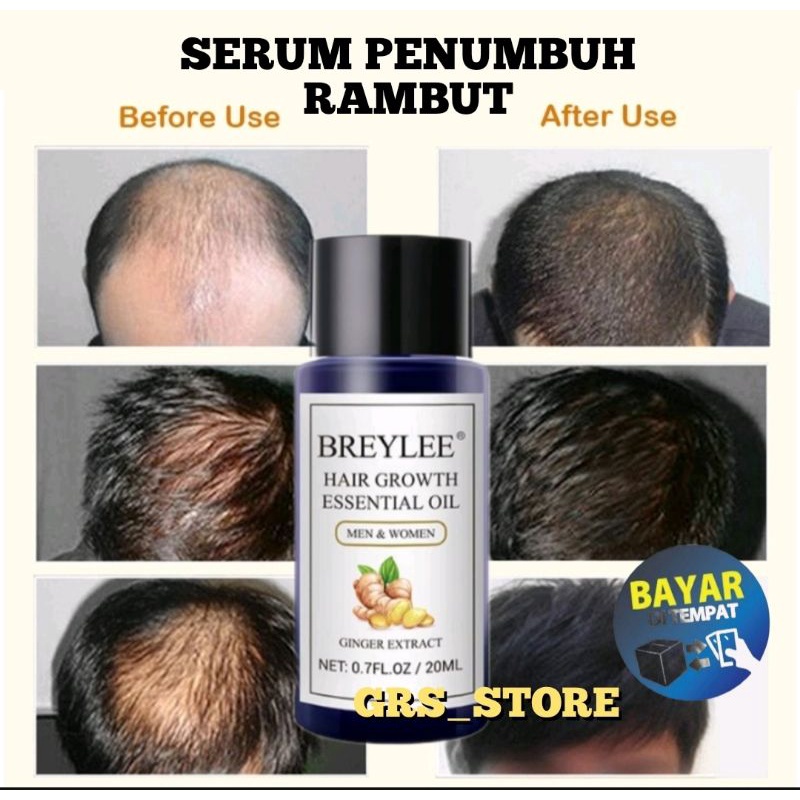 SERUM PENUMBUH RAMBUT TERCEPAT