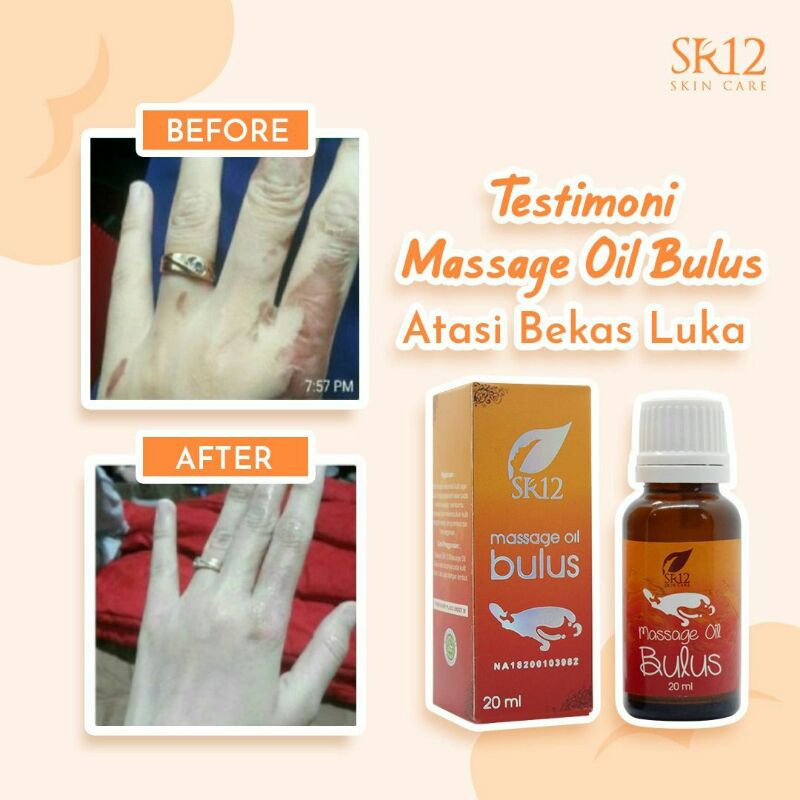 Minyak Bulus SR12 Pembesar Payudara Penghilang Strechmark Stretch Mark Massage Oil Pengencang Kulit Wajah Dan Tubuh Bulus Asli Obat Jamur Gatal BPOM Tidak Bau Amis 20ml