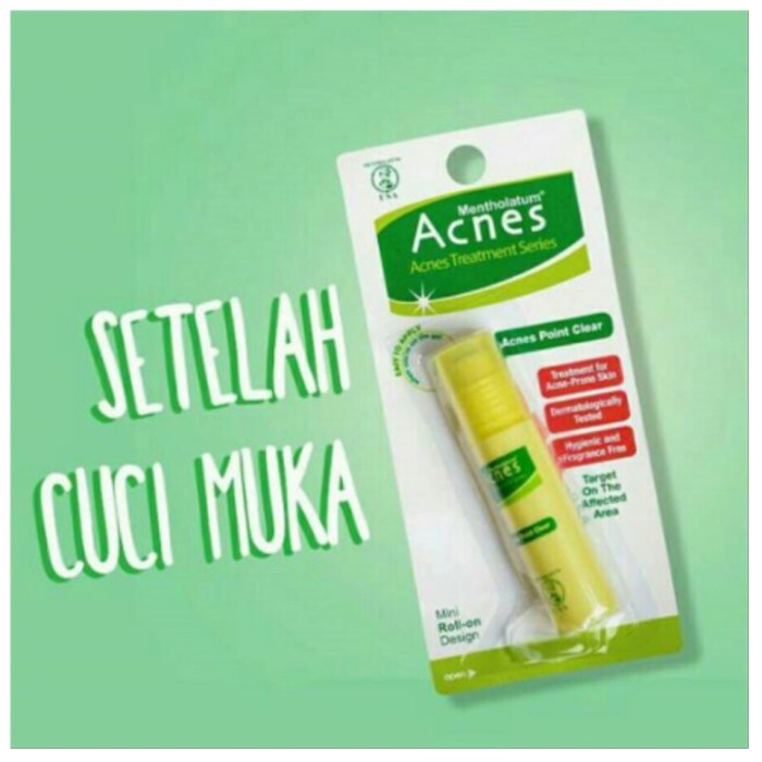 Acnes Point Clear Roll On / Penghilang Jerawat / Cream / Obat Jerawat