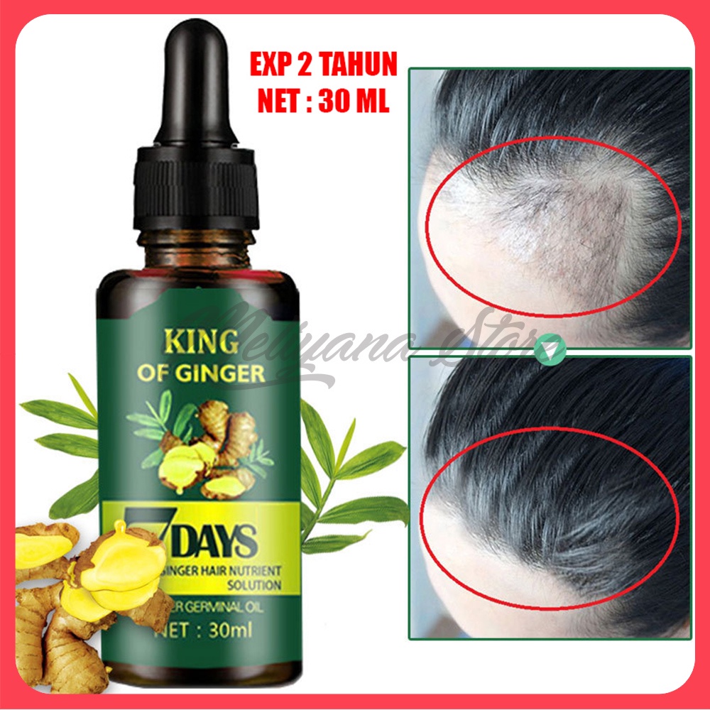 7 Days Clothes Of Skin Ginger Germinal Oil Minyak Penumbuh Rambut