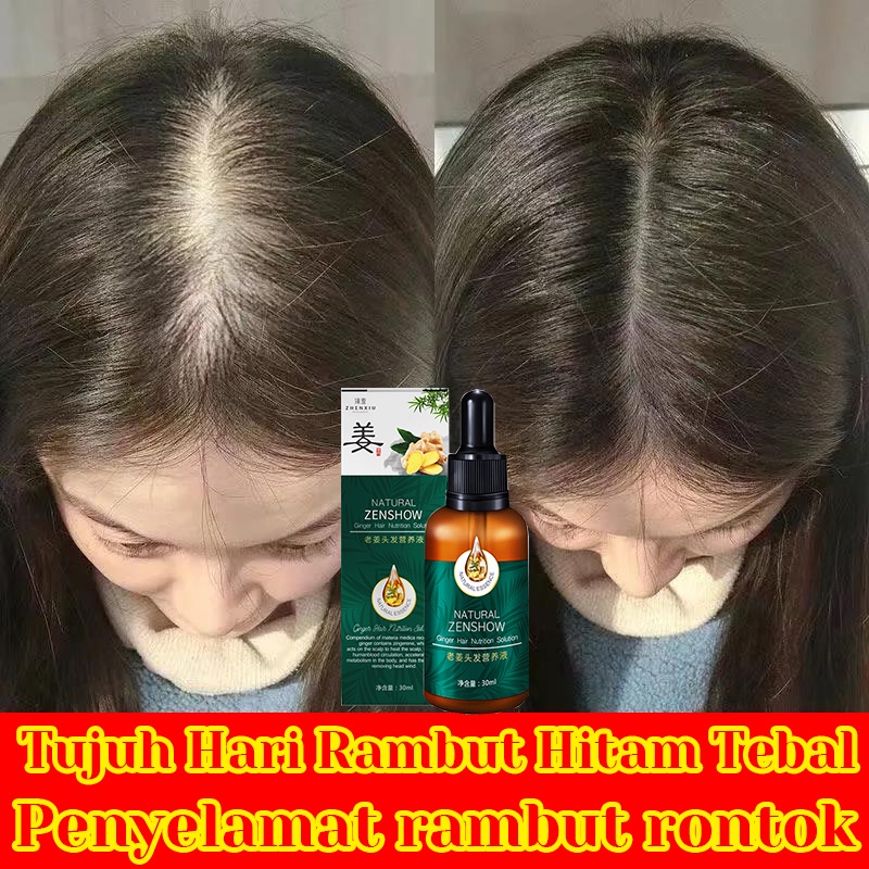 【O'RANNLE】Ekstrak Jahe Murni Mengentalkan Rambut Bayi dan Dewasa, Jenggot, Kumis, Jenggot, Alis Vitamin jahe rambut  Vitamin rambut Pertumbuhan rambut  Musuh botak   Cairan penumbuh rambut  Cairan pertumbuhan