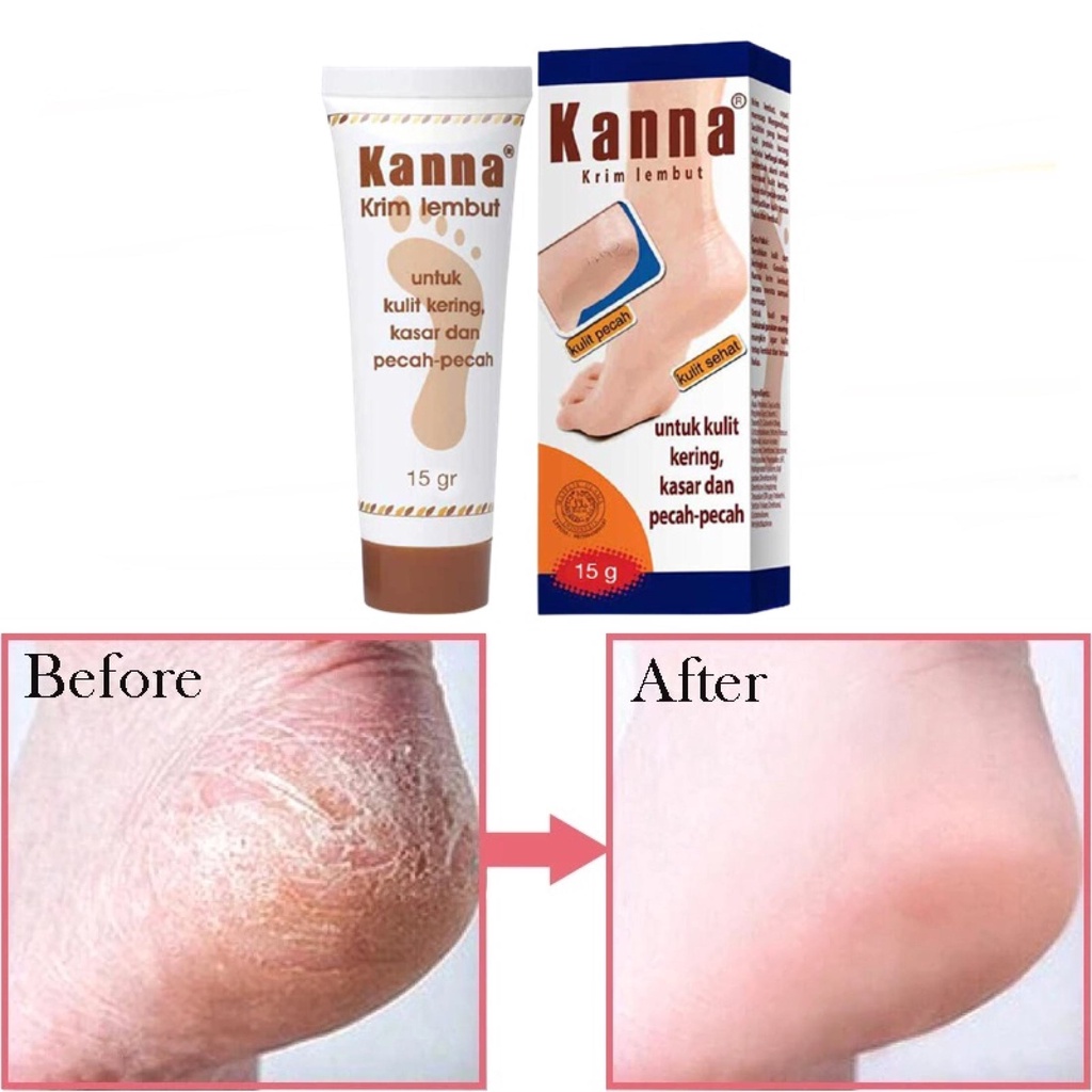 [BISA COD] Kanna Krim Kaki Krim Lembut Menagatasi Tumit Pecah Kaki Kasar Kulit Pecah