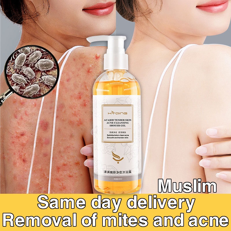 Acne Body Wash / Whitening Body Wash / 100% herbal / Parfum Alami Shower Gel / Repair Skin / Jerawat Kulit --260ml