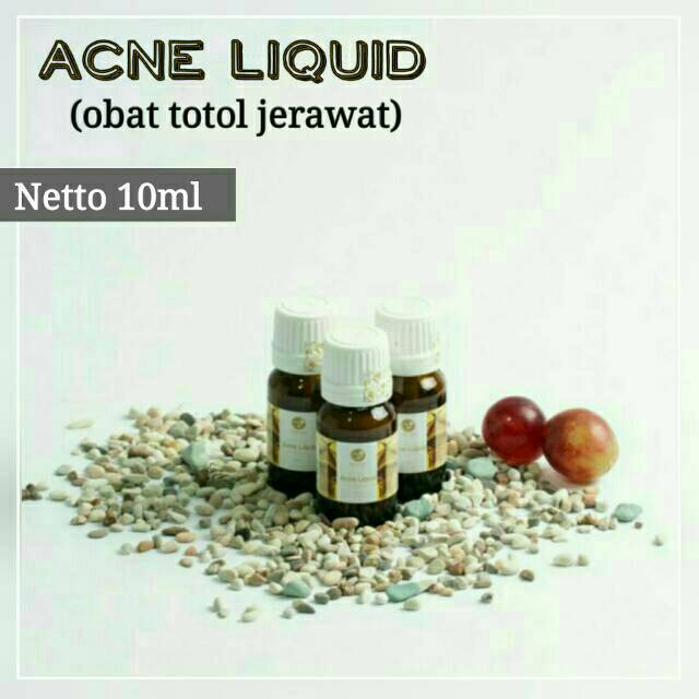 Acne Liquid Obat jerawat V Beauty Care Victory Beauty Care