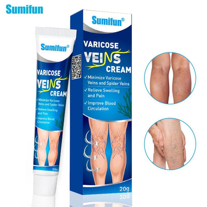 Salep Varises Cream Varicose Veins Obat Varises Kemaluan Bengkak Benjolan Buah Zakar Nyeri Testis Varicose Veins Cream 20Gr