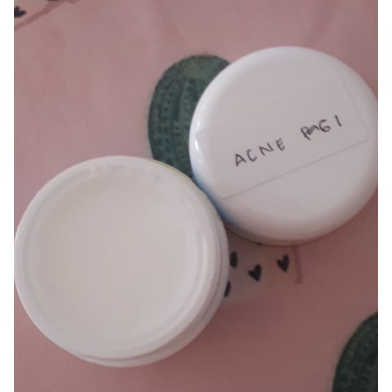 cream pagi acne