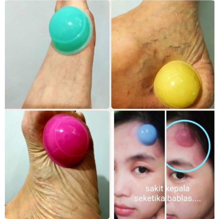 Kop Angin (bekam kering+kerokan) CPK Set ORIGINAL